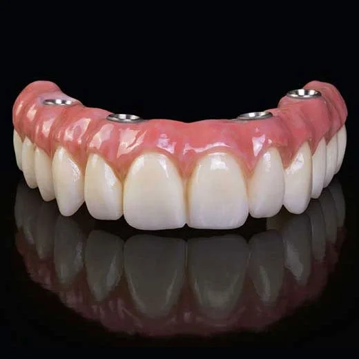 Dentures treatment Chennai