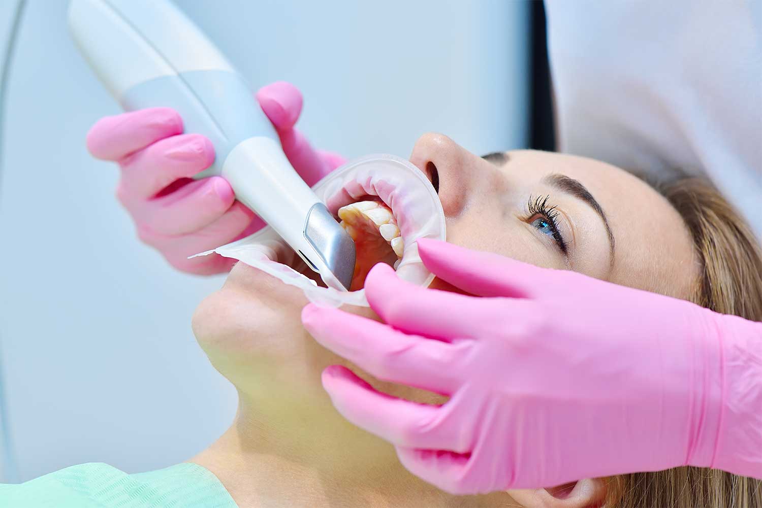 Intra oral scan dental clinic